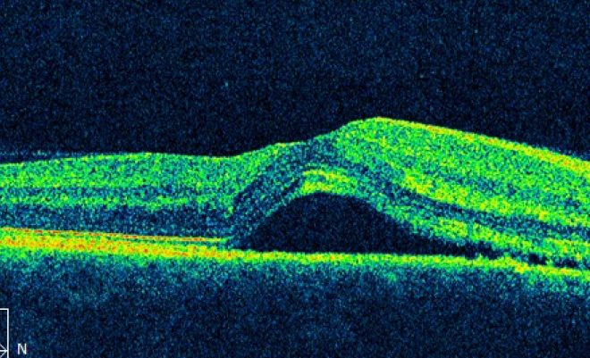 Color image of retina taken by Optical Coherence Tomography