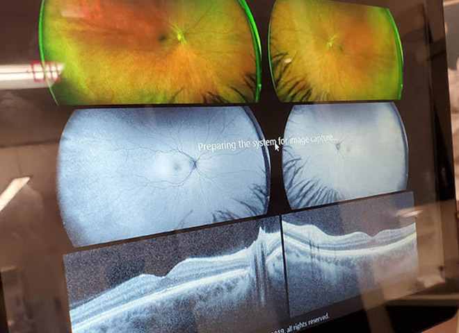 screen with microscopic digital imaging of eye