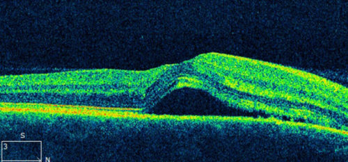 Color image of Optical Coherence Tomography